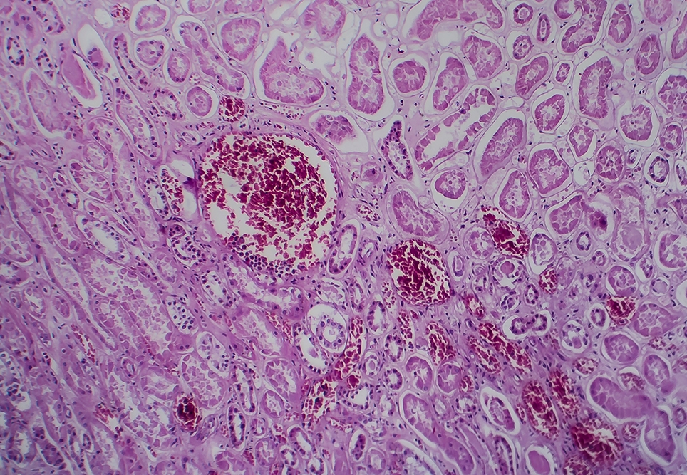 APSGN in focus